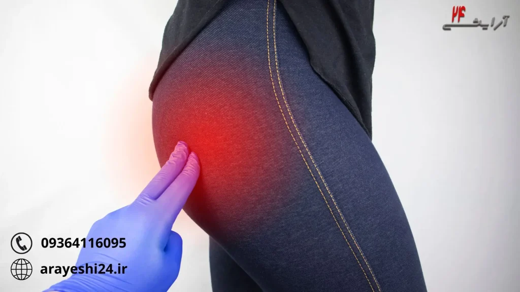 چگونه باسنی سفید و بدون جوش داشته باشیم