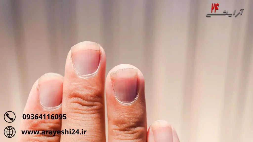 قرص ویتامین برای ناخن