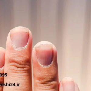 قرص ویتامین برای ناخن