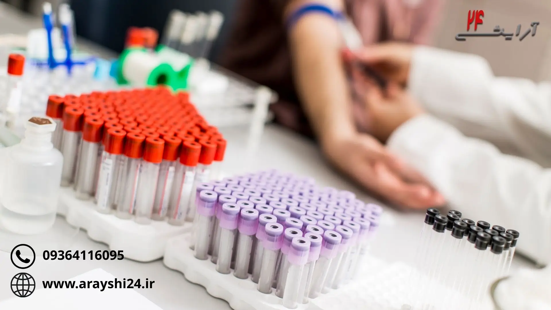 آزمایش زگیل تناسلی