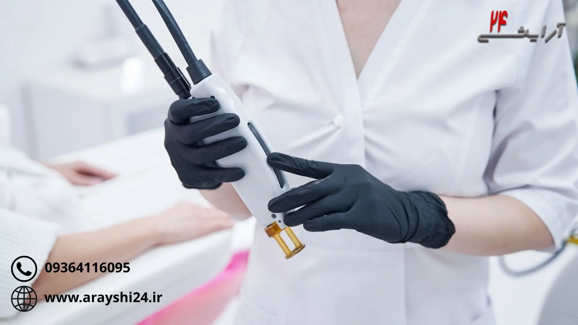 لیزر زگیل تناسلی