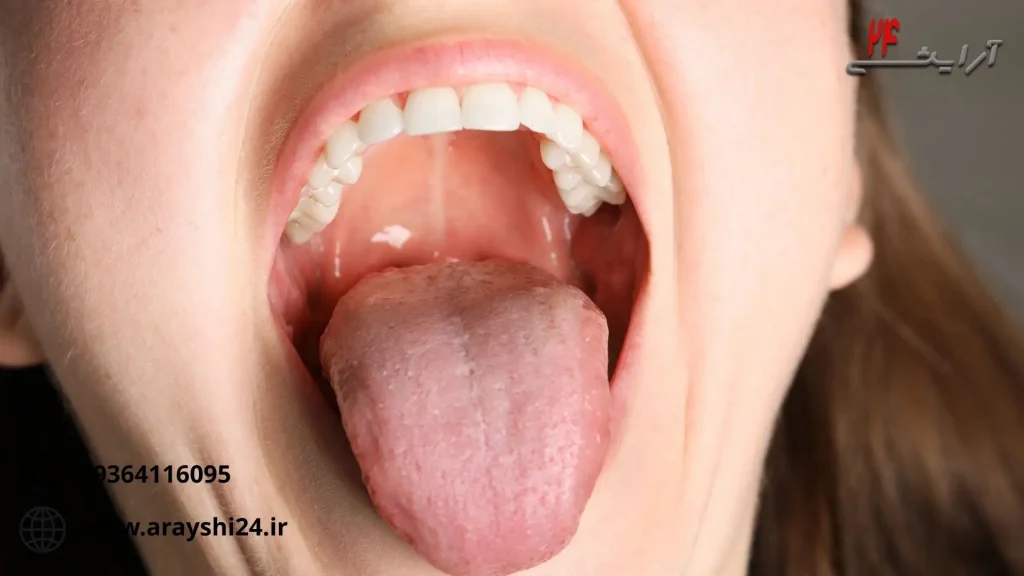 انتقال hpv