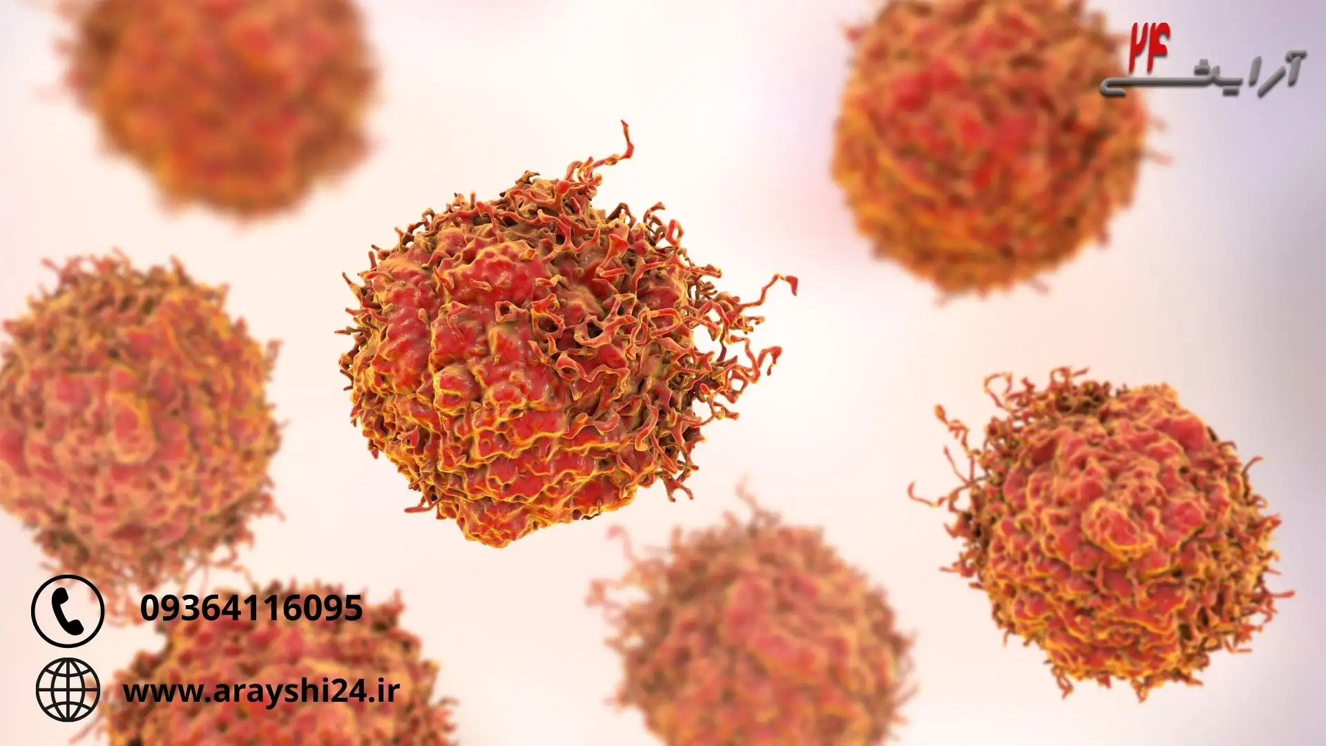 صفر تا صفر درمان hpv